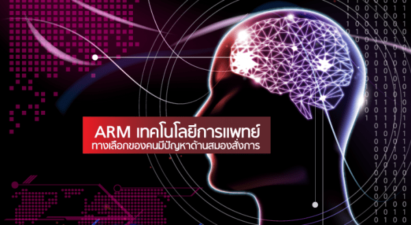 ARM