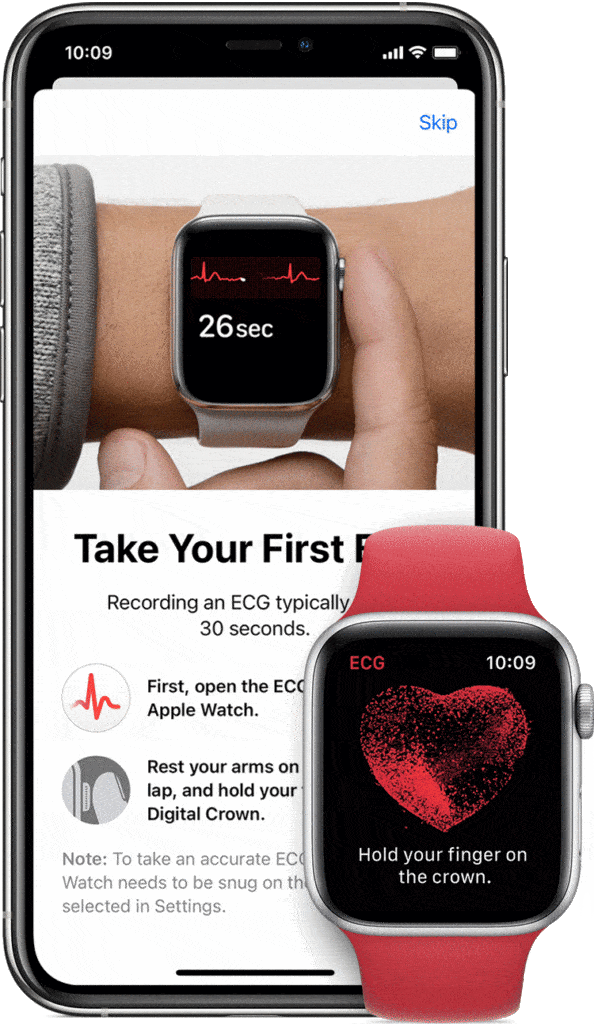 วิธีแชร์ ECG บน Apple Watch